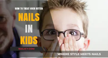 Healing Tiny Tips: Effective Treatments for Over-Bitten Nails in Kids
