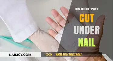 Quick Fixes for Paper Cuts Under Nails
