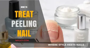 Revitalize Your Nails: Effective Treatments for Peeling and Brittleness