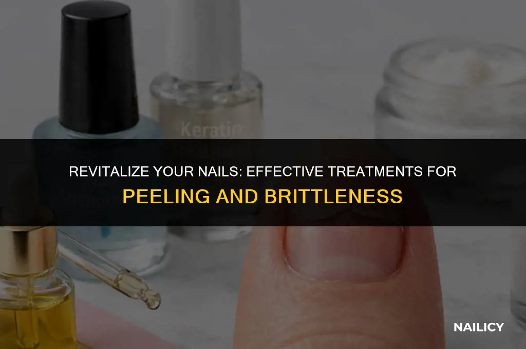 how to treat peeling nail