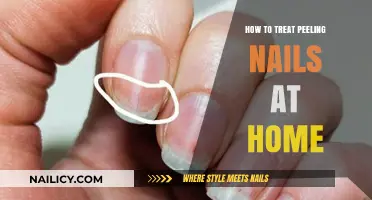 Effective Home Remedies to Repair and Strengthen Peeling Nails