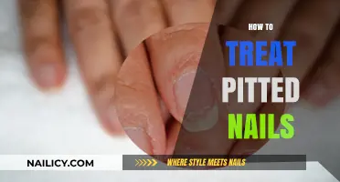 Revitalize Your Nails: Effective Treatments for Pitted Nail Beds