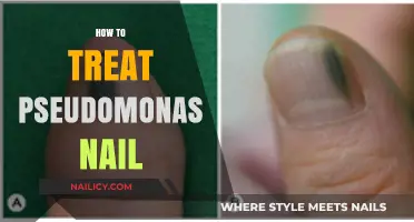 Combatting Pseudomonas Nail Infections: A Comprehensive Treatment Guide