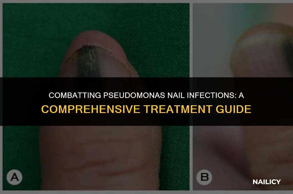 how to treat pseudomonas nail