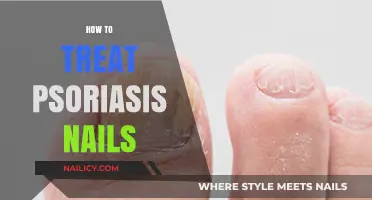 Effective Ways to Manage and Treat Psoriasis-Affected Nails