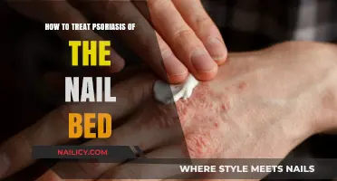 Effective Nail Psoriasis Treatment: Tips for Healthy Nail Beds
