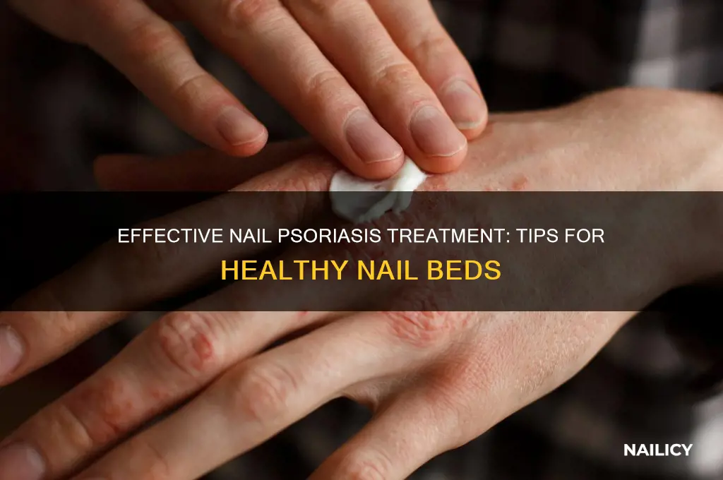 how to treat psoriasis of the nail bed