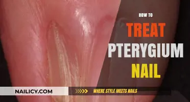 Effective Ways to Treat and Prevent Pterygium Nails