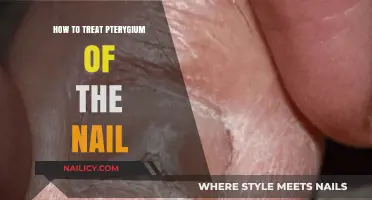 Effective Treatment Strategies for Pterygium of the Nail Explained