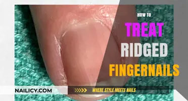 Smooth Solutions: Effective Treatments for Ridged Fingernails Explained