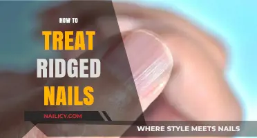 Smooth Solutions: Treating Ridged Nails for a Polished Look