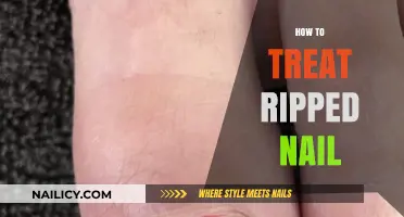 Nail Care Essentials: Healing and Preventing Ripped Nails
