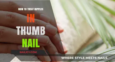 Treating Thumb Nail Ripples: Effective Remedies and Prevention Tips