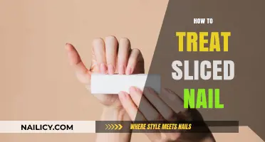 Healing Your Sliced Nail: A Step-by-Step Guide