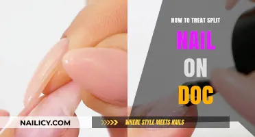 Effective Ways to Treat a Split Nail at Home: A Guide