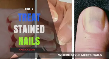 Revive Your Nails: Effective Tips to Treat Stained Nails