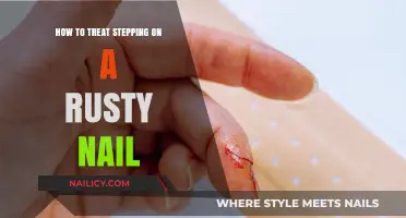 Rusty Nail Injury: Immediate Steps and Treatment for Prevention