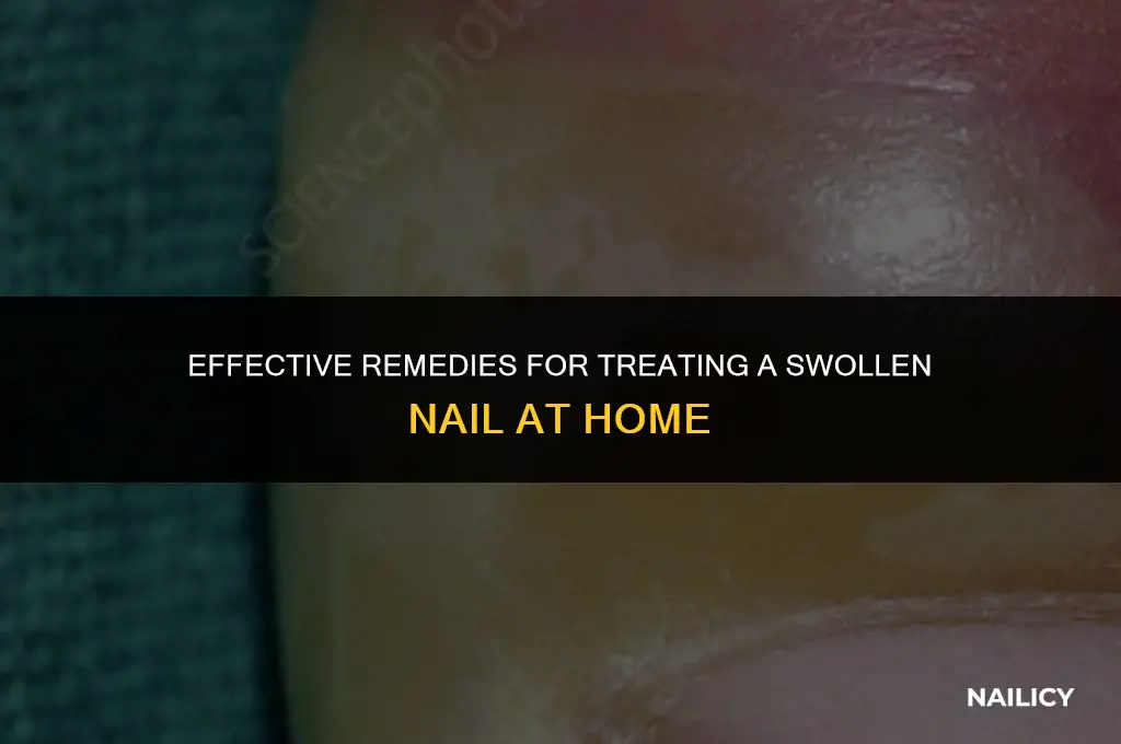 how to treat swollen nail