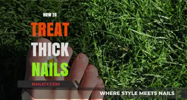 Effective Remedies for Thick Nails: Simple Treatment Tips for Healthy Feet