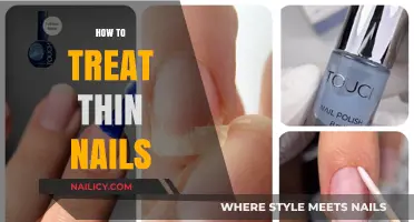 Strengthening Your Nails: A Comprehensive Guide to Treating Thin Nails