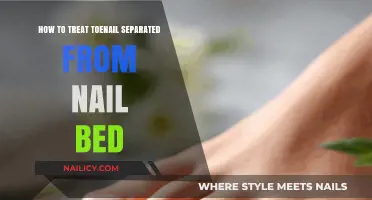 Effective Ways to Treat a Toenail Separated from the Nail Bed