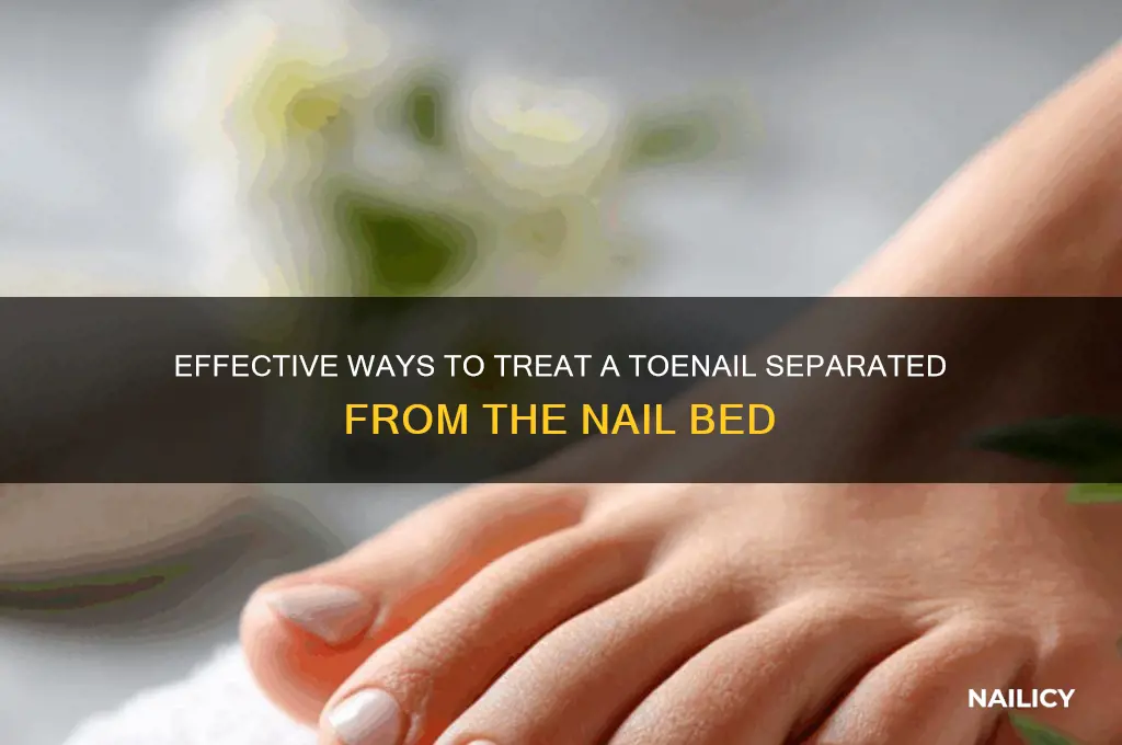 how to treat toenail separated from nail bed
