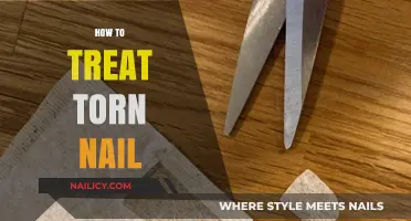 Quick & Gentle Remedies for Healing a Torn Nail at Home