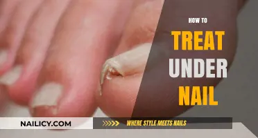Effective Remedies for Treating Painful Under-Nail Conditions