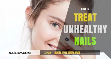 Revitalize Your Nails: A Comprehensive Guide to Treating Unhealthy Nails