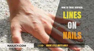 Treating Vertical Nail Lines: Effective Remedies and Prevention Tips