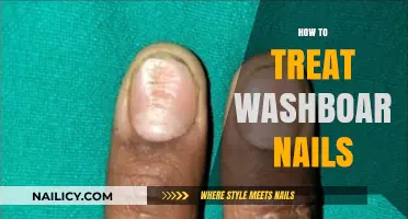 Revitalize Your Nails: A Comprehensive Guide to Treating Washboard Nails