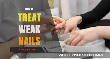 Strengthen Your Nails: A Comprehensive Guide to Treating Weakness