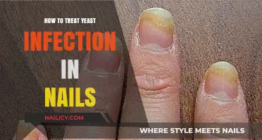 Effective Nail Yeast Infection Treatment: Remedies and Prevention Tips