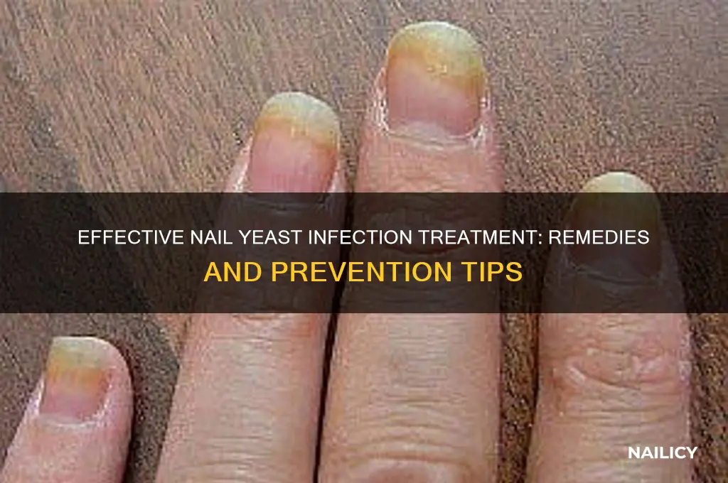 how to treat yeast infection in nails