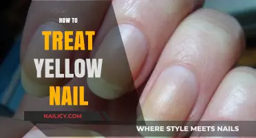 Revive Your Nails: Effective Treatments for Yellow Nail Syndrome