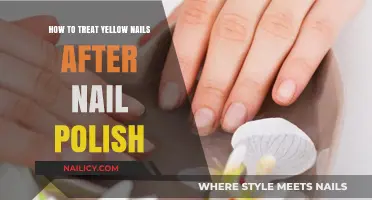 Revive Yellow Nails: Post-Polish Treatment Tips for Healthy, Bright Nails