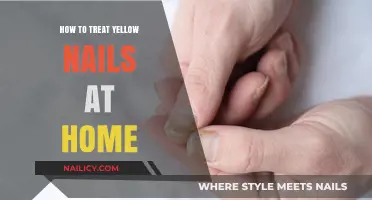 Effective Home Remedies to Restore and Treat Yellow Nails Naturally
