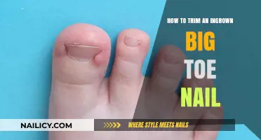 Trimming an Ingrown Big Toenail: A Step-by-Step Guide