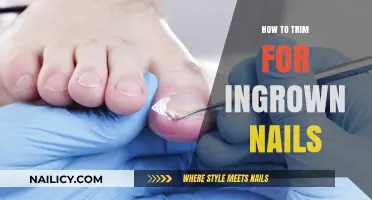 Trimming for Ingrown Nails: A Step-by-Step Guide