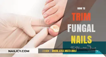 Trimming Fungal Nails: The Right Way to Do It