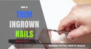 Trimming Ingrown Nails: A Step-by-Step Guide to Healthy Toes
