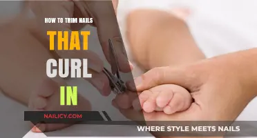 Trimming Techniques for Ingrown Toenails: A Step-by-Step Guide