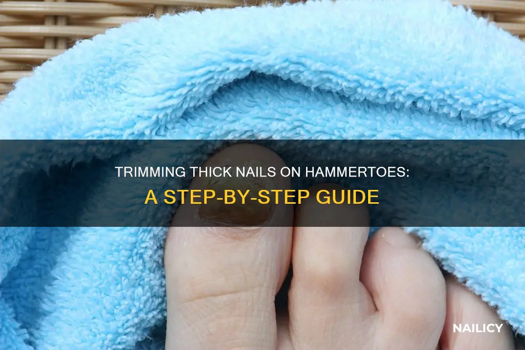 how to trim thick nails on hammertoe