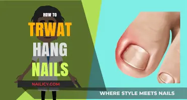 Say Goodbye to Hangnails: A Comprehensive Guide to Prevention and Treatment