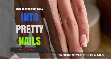 Transform Ugly Nails: Simple Steps to Achieve Pretty, Healthy Nails