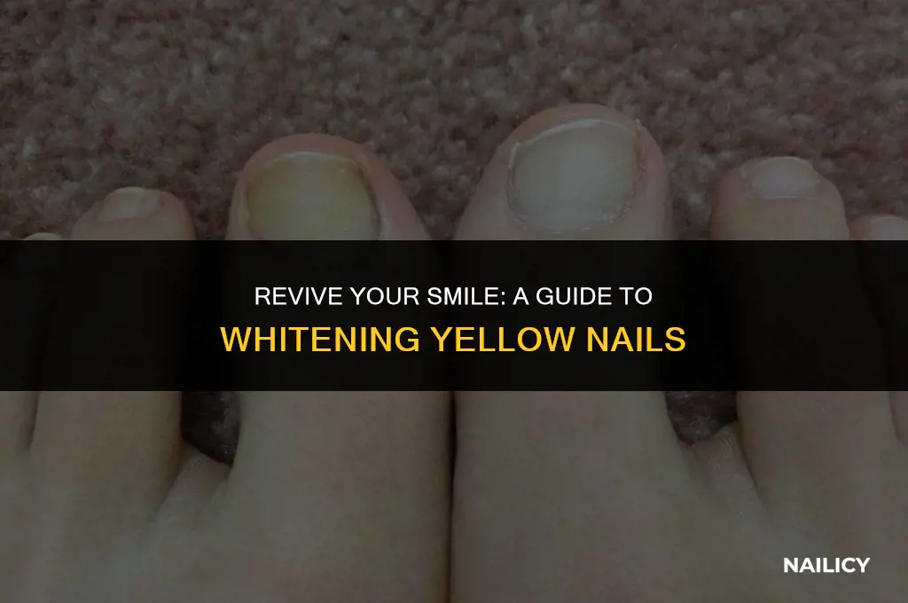 how to un yellow nails