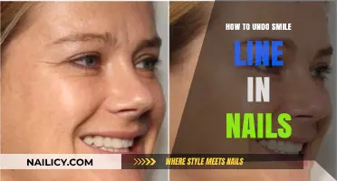 Undo Smile Lines in Nails: Simple Techniques for Flawless Manicures