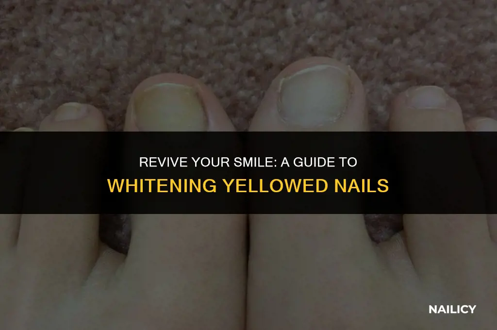 how to unyellow your nails
