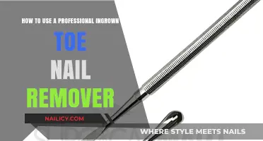 Expert Ingrown Toenail Removal: A Step-by-Step Guide