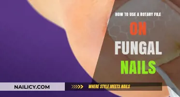 Effective Rotary Filing Techniques for Treating Fungal Nails